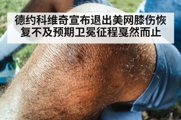德约科维奇宣布退出美网膝伤恢复不及预期卫冕征程戛然而止